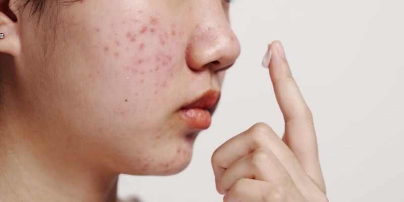 Too many skincare products